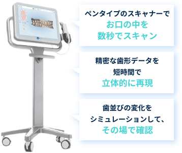 3D光学スキャナー「iTero」